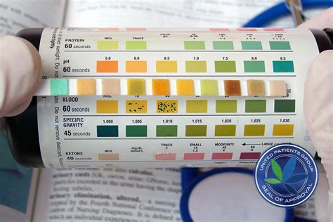 6.5 ph urine|ph urine 7.5 cosa significa.
